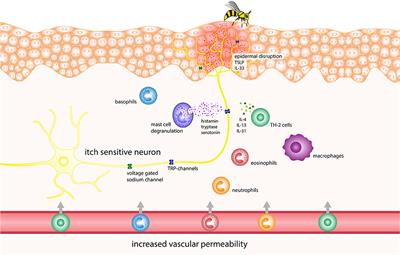 Itch in Hymenoptera Sting Reactions
